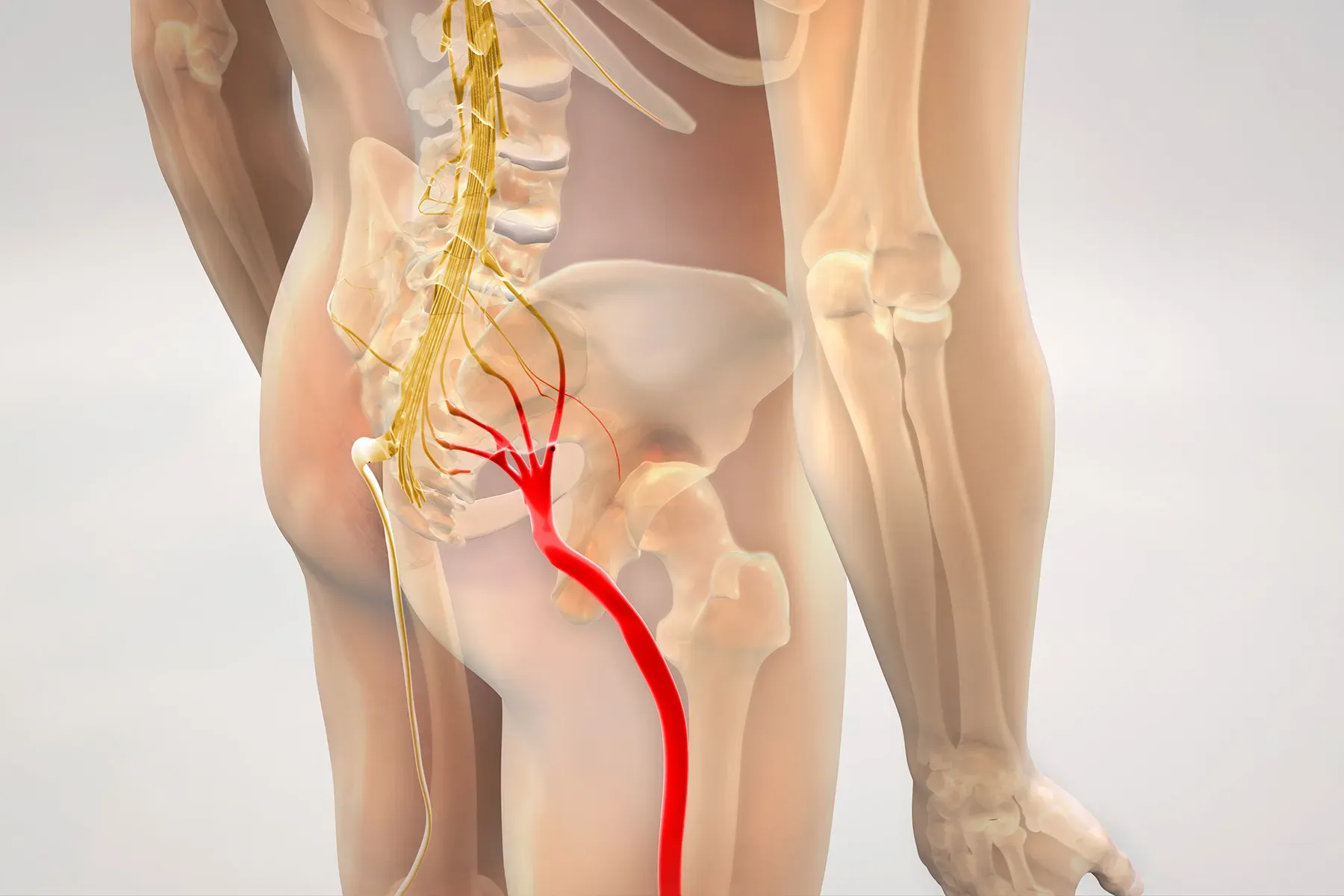 Sciatica: Causes, Symptoms & Advanced Treatment.