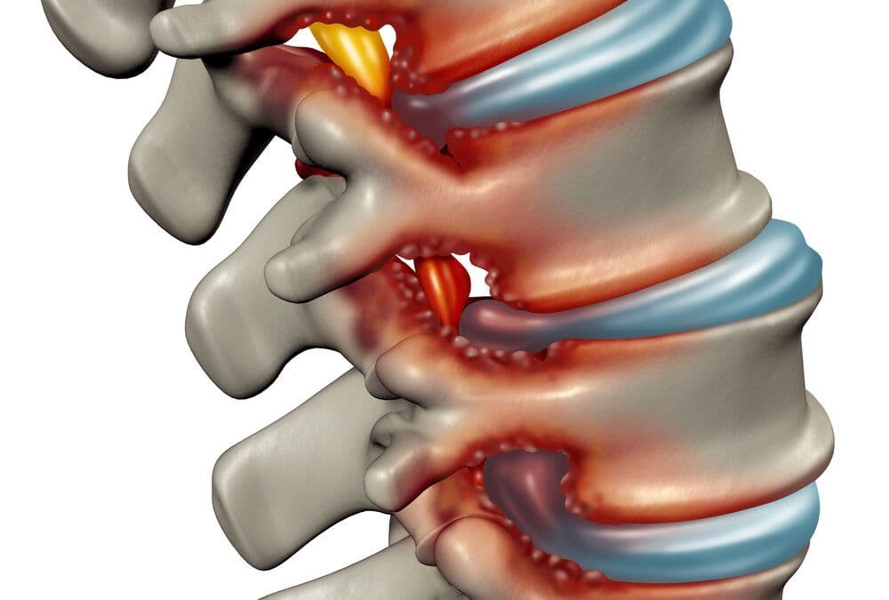 Illustration of treated conditions