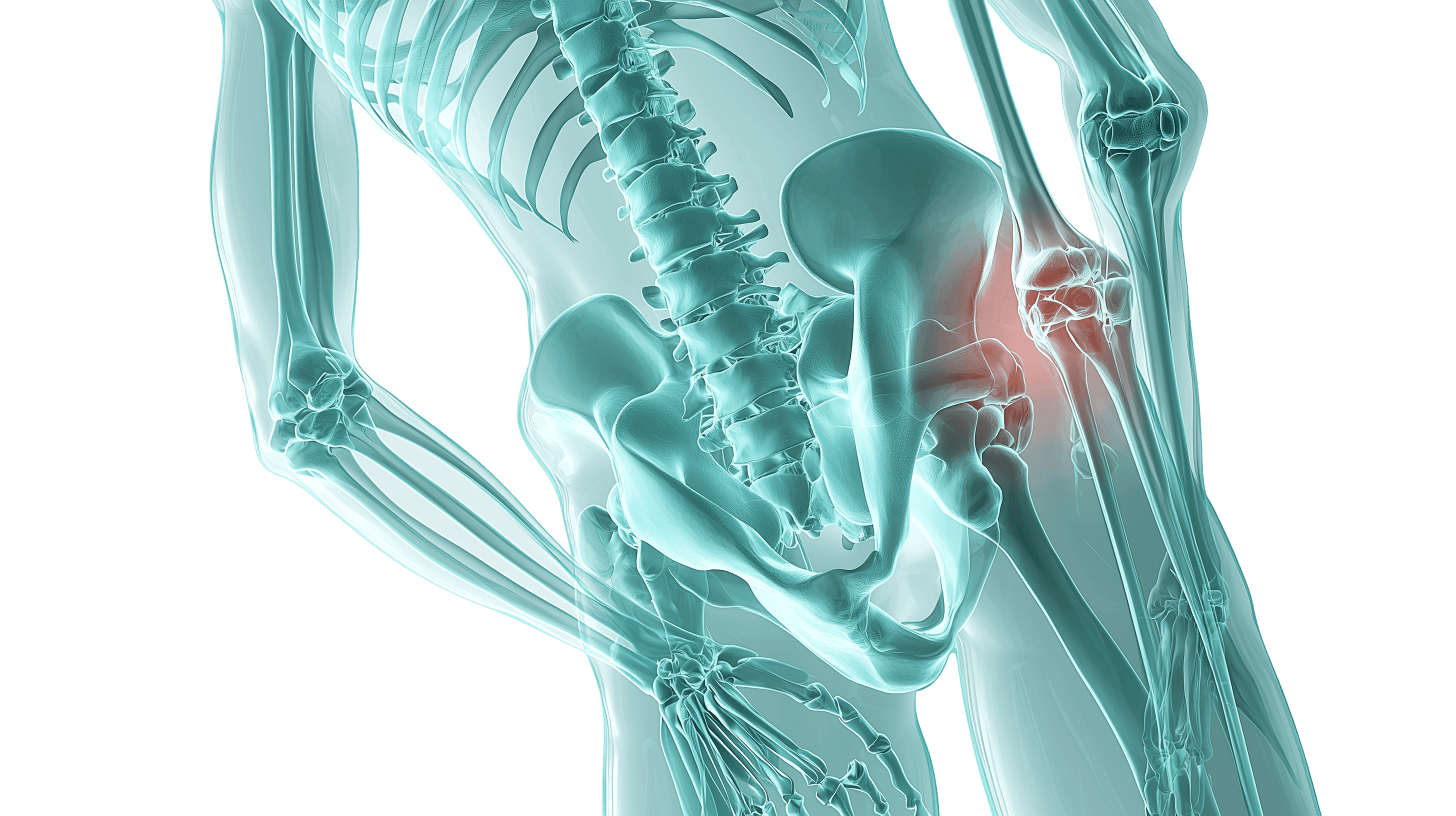 Orthopedics